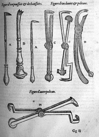 Histoire du bistouri, l'instrument incontournable en chirurgie